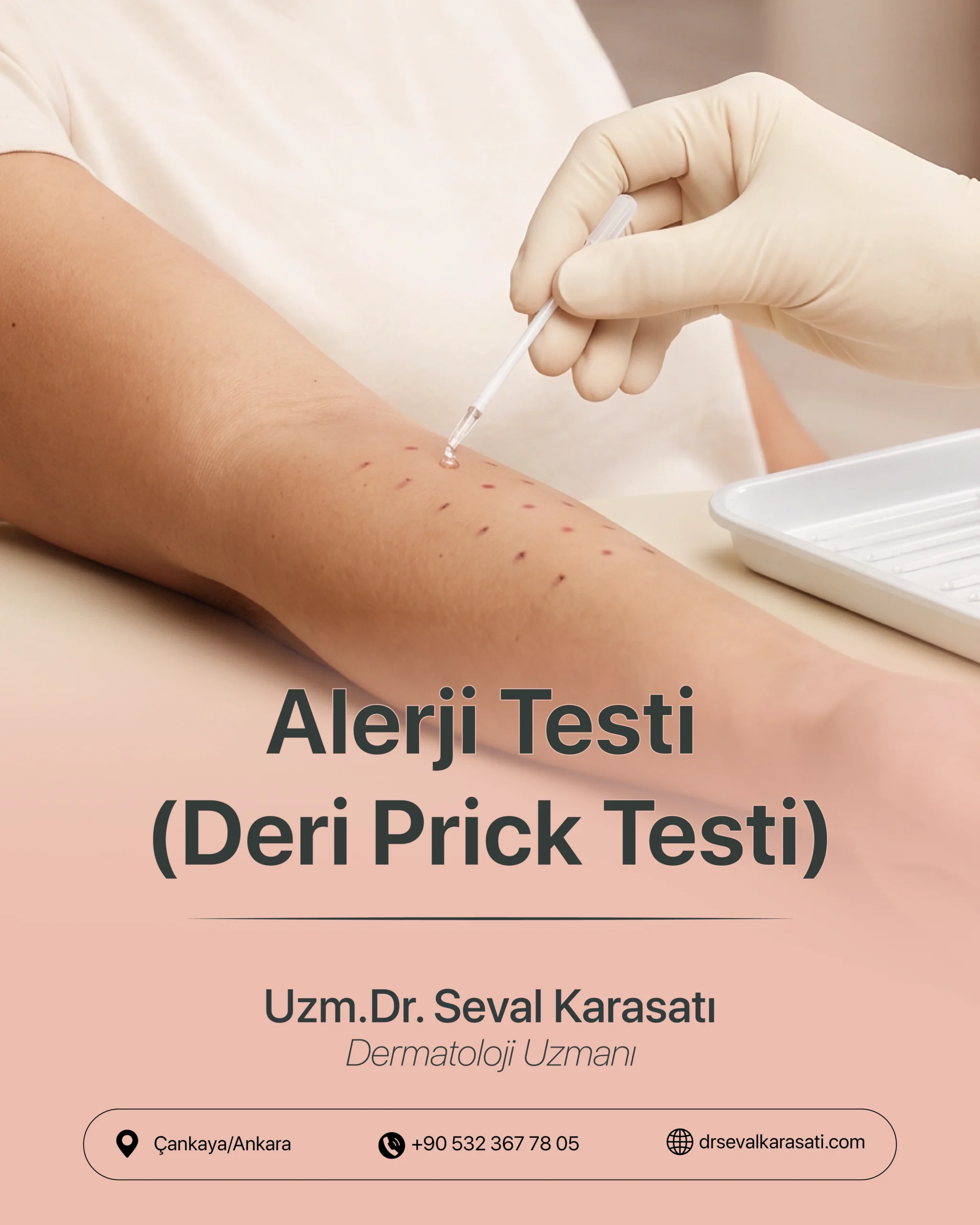 Alerji Testi (Deri Prick Testi)