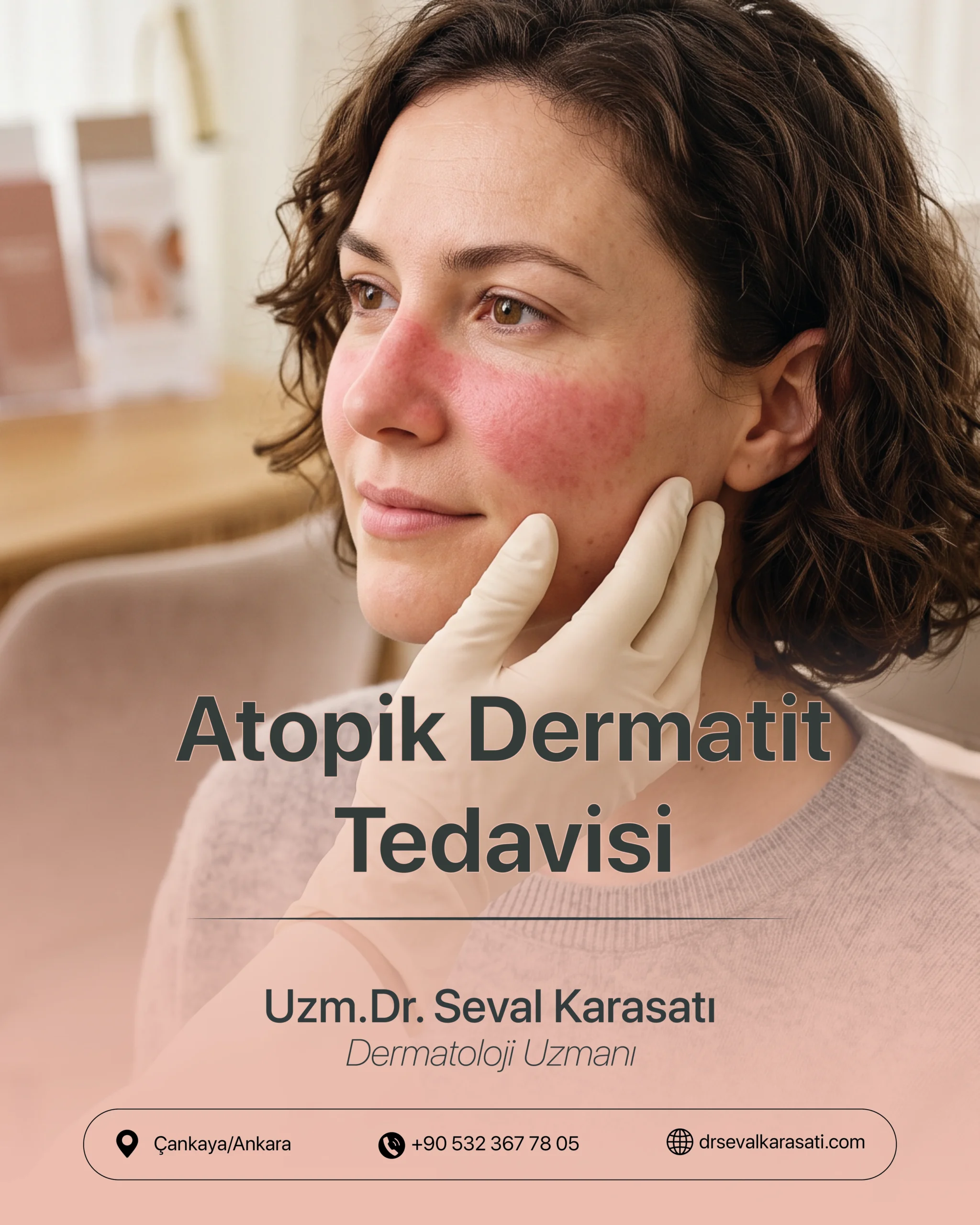Atopik Dermatit Tedavisi