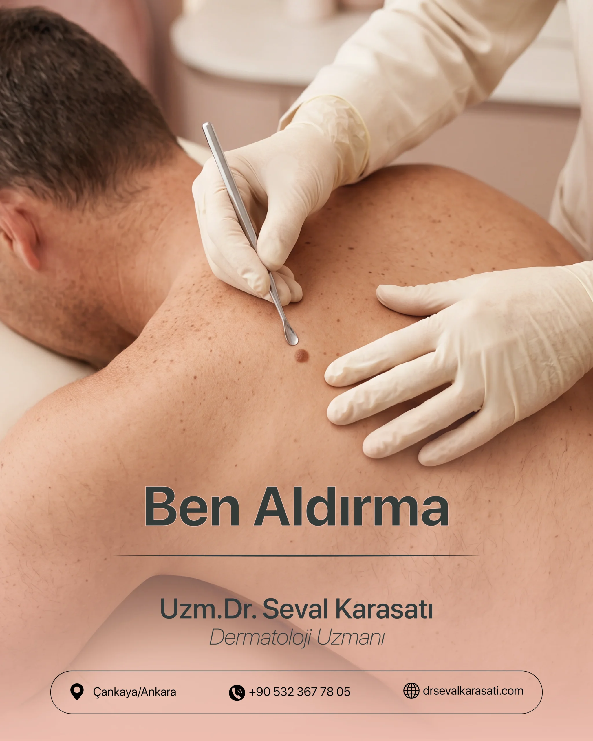 Ben Aldırma