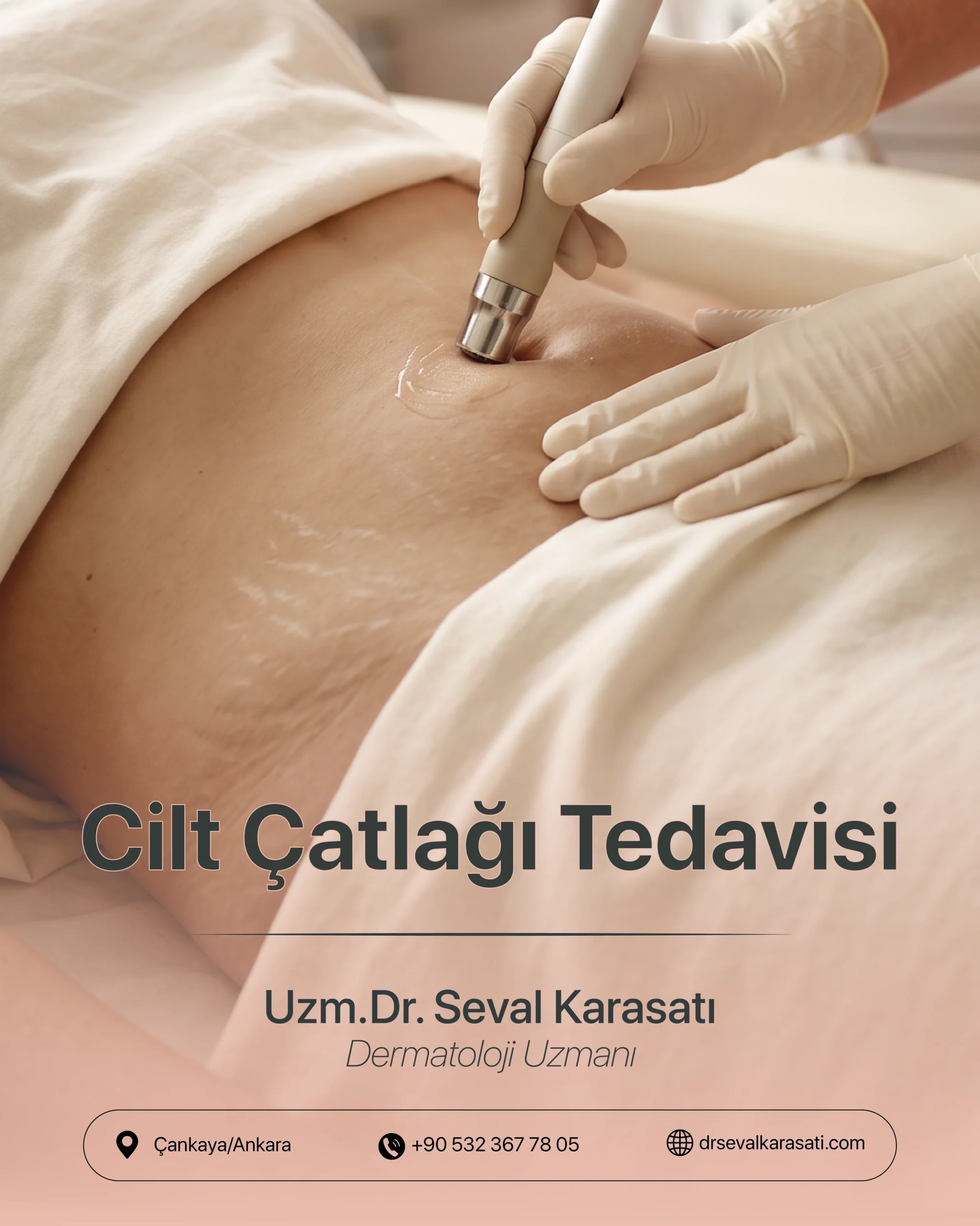 Cilt Çatlağı Tedavisi