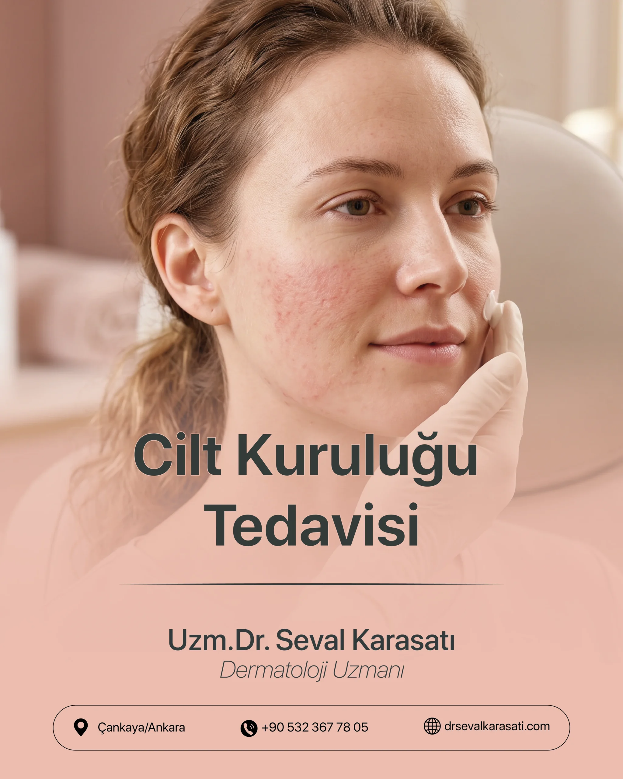 Cilt Kuruluğu Tedavisi