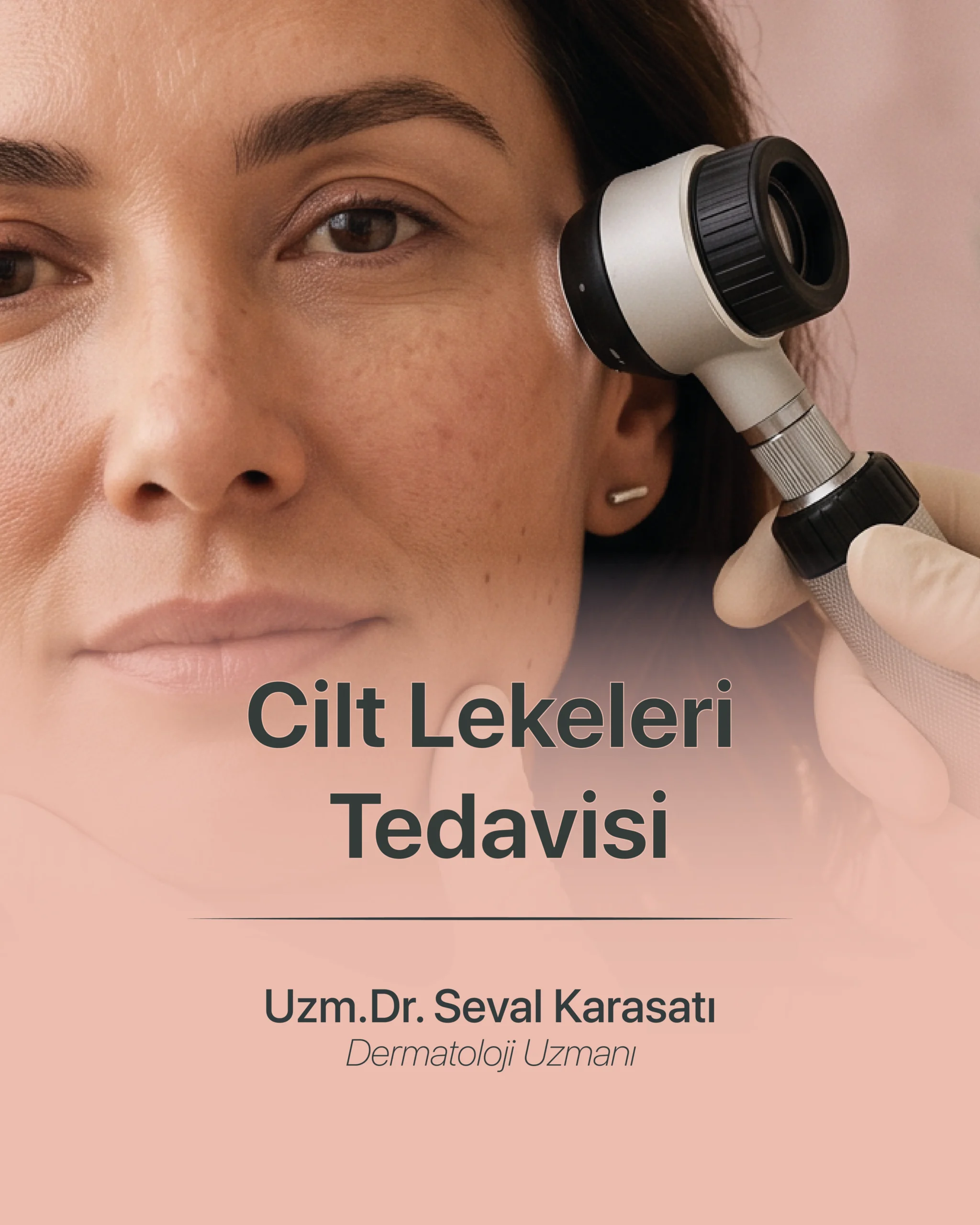 Cilt Lekeleri Tedavisi