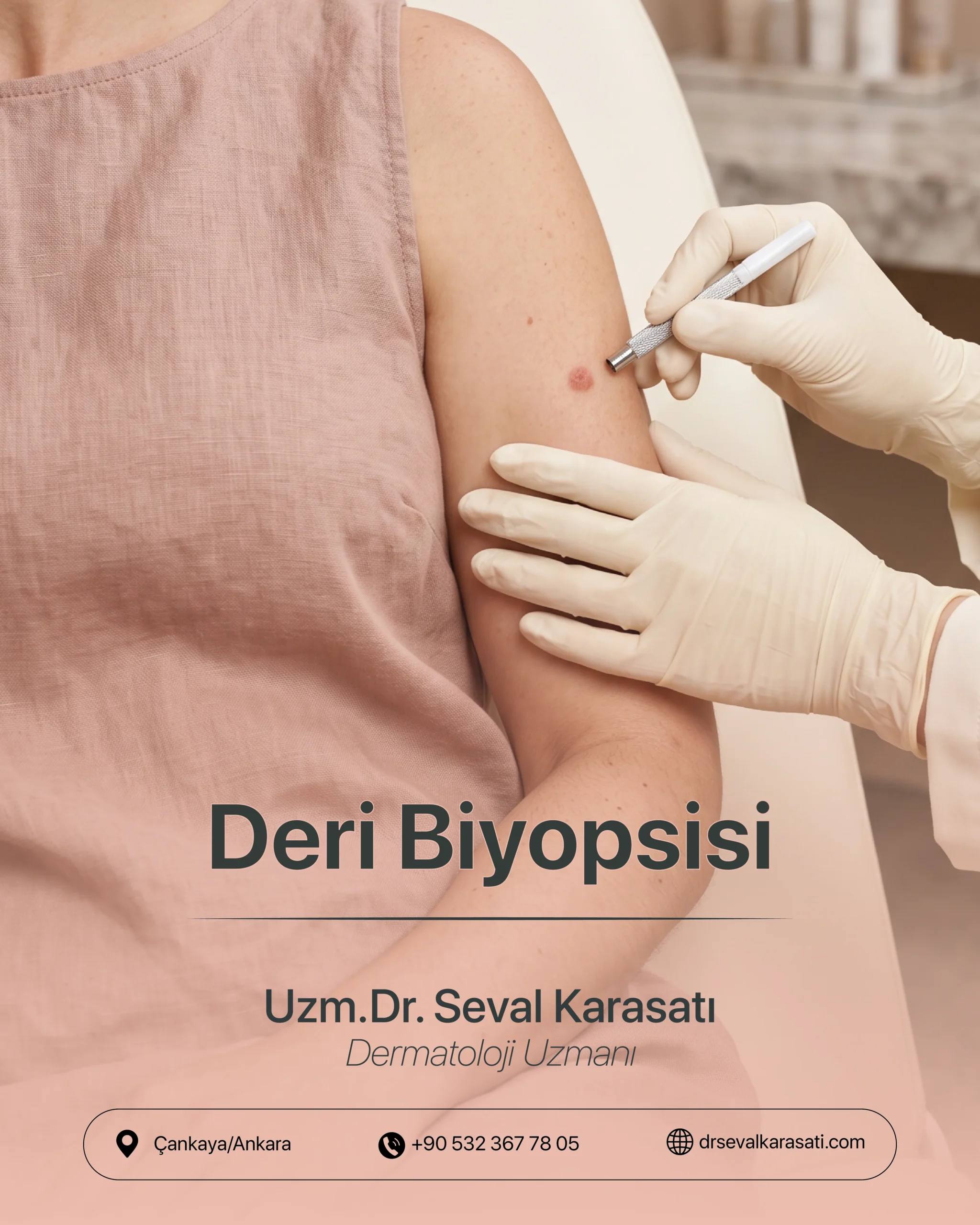 Deri Biyopsisi