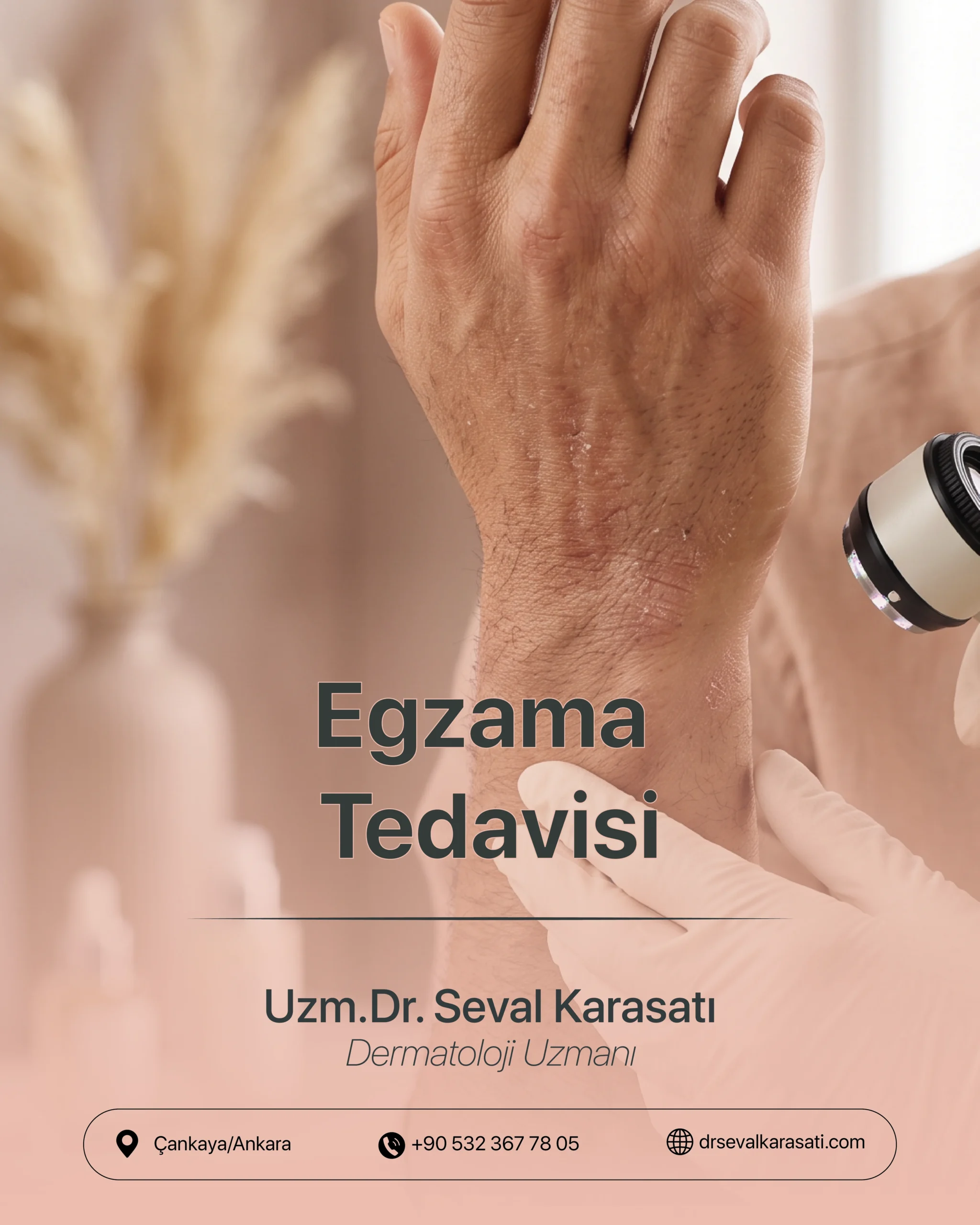 Egzama Tedavisi
