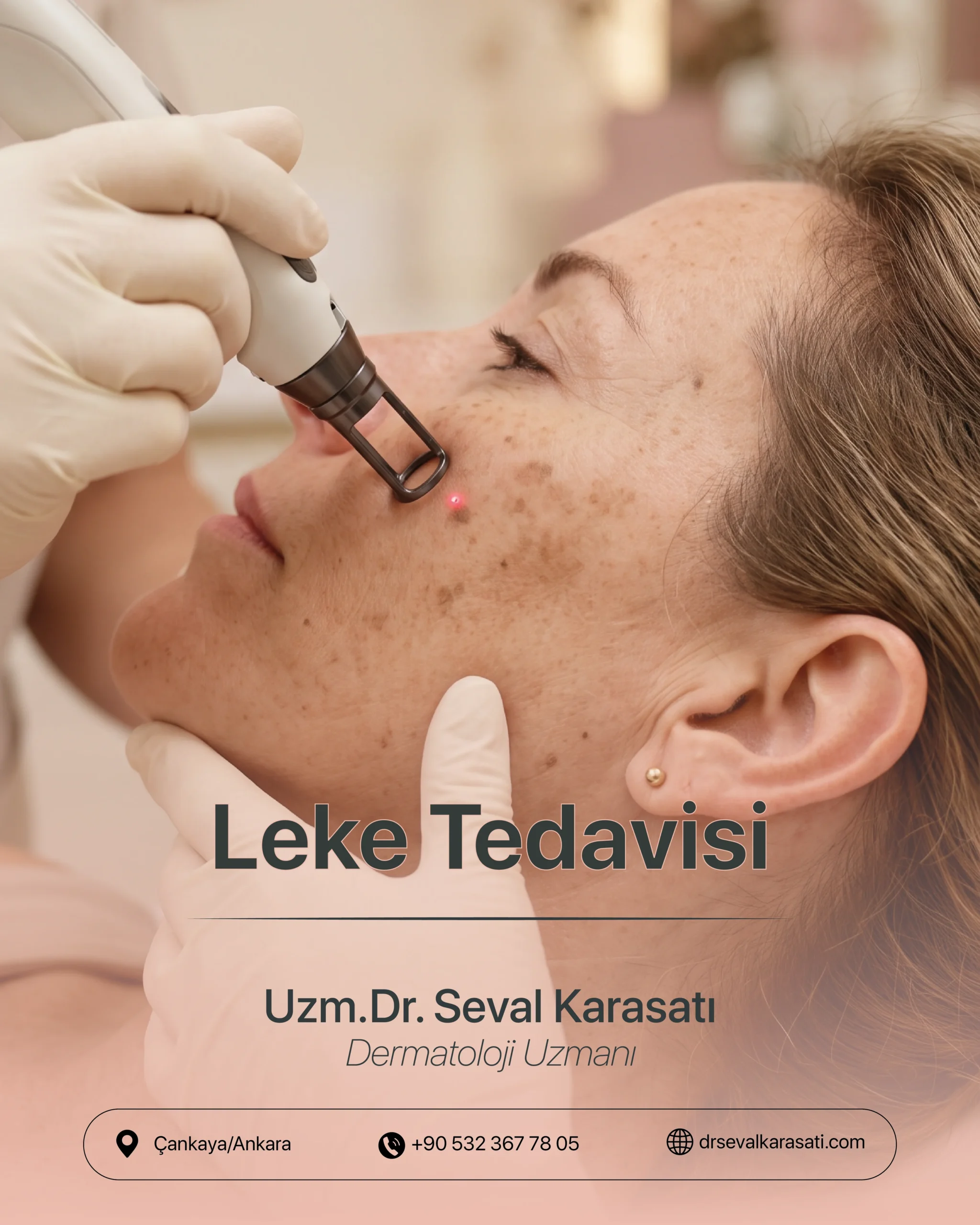 Leke Tedavisi