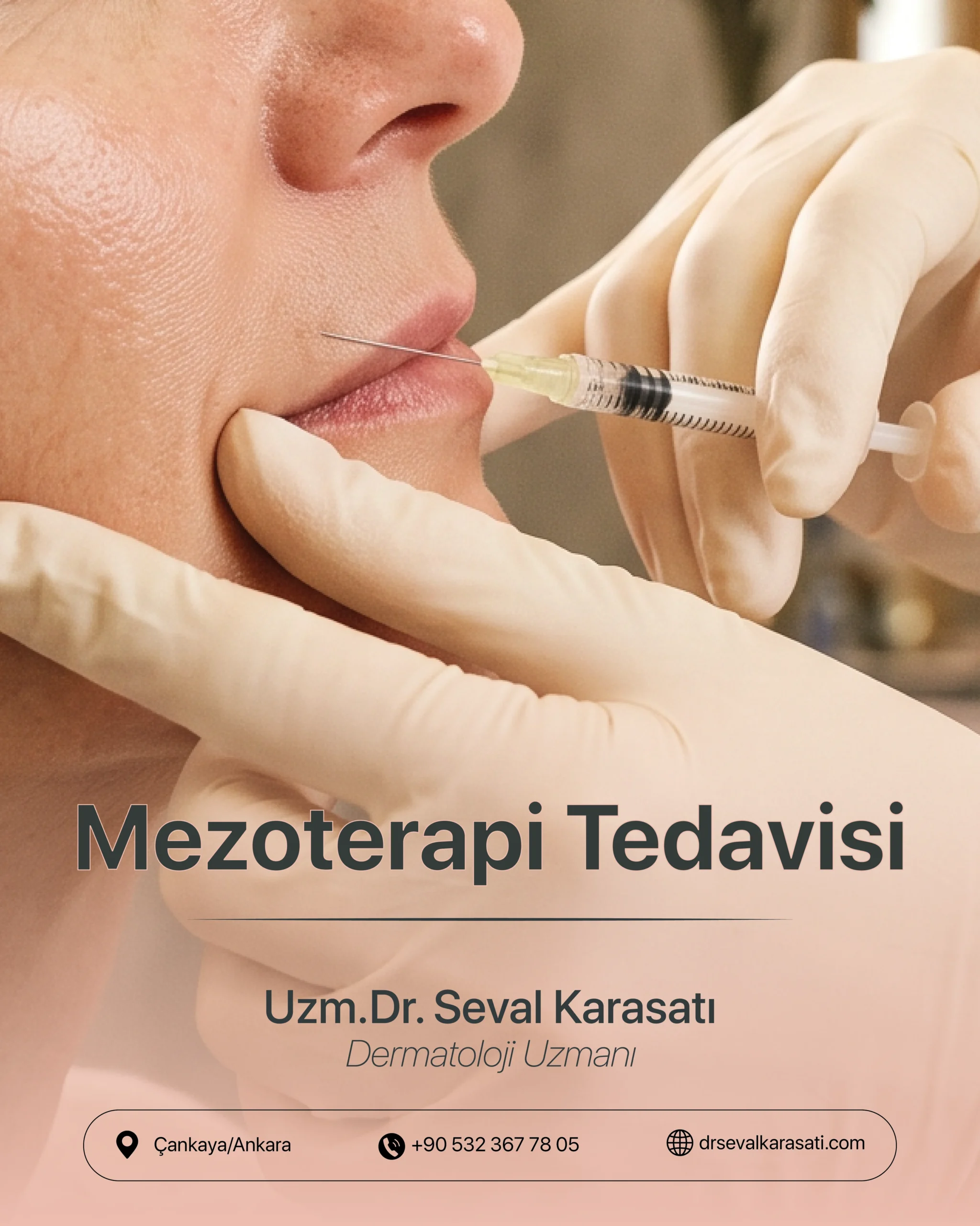 Mezoterapi Tedavisi