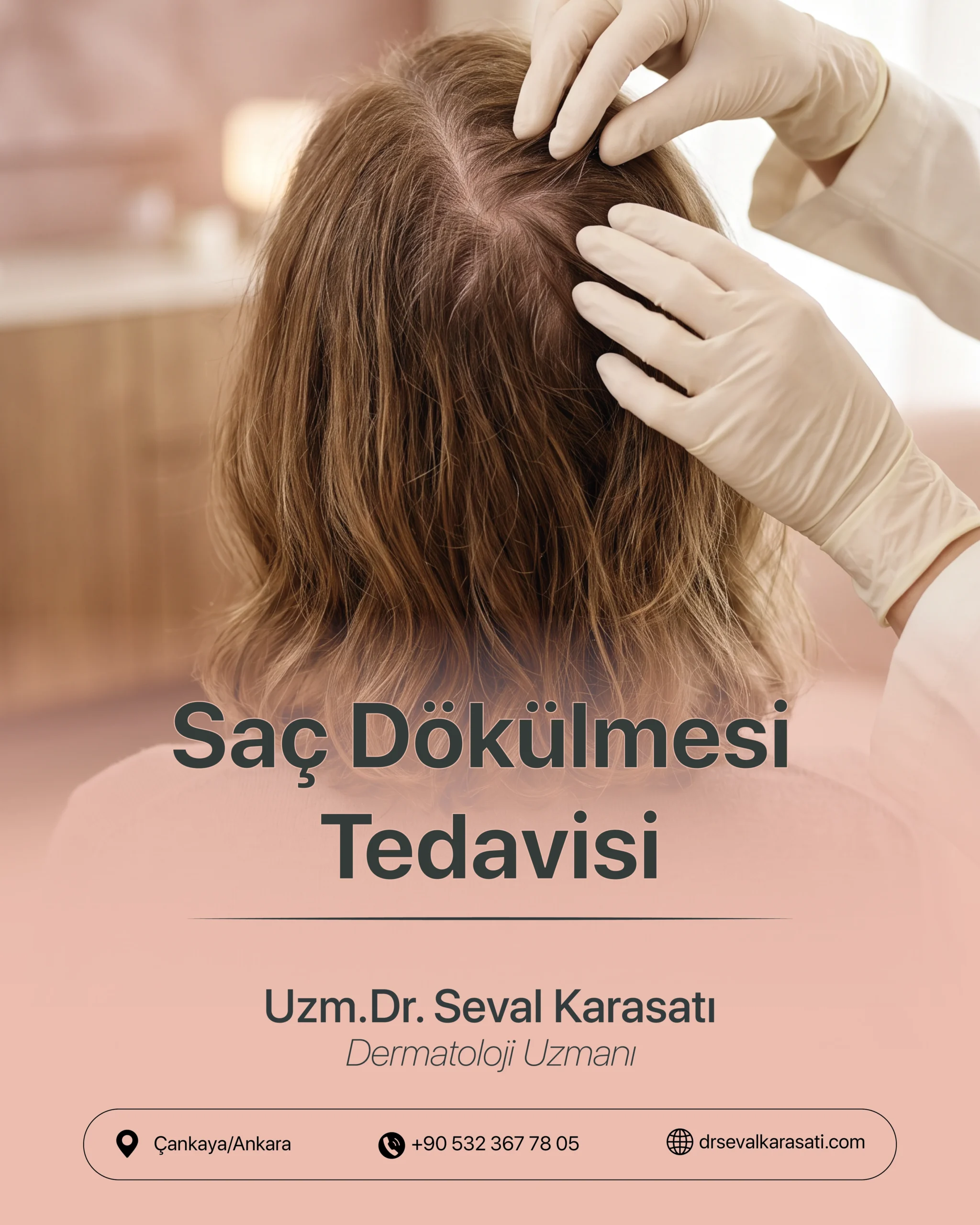 Saç Dökülmesi Tedavisi