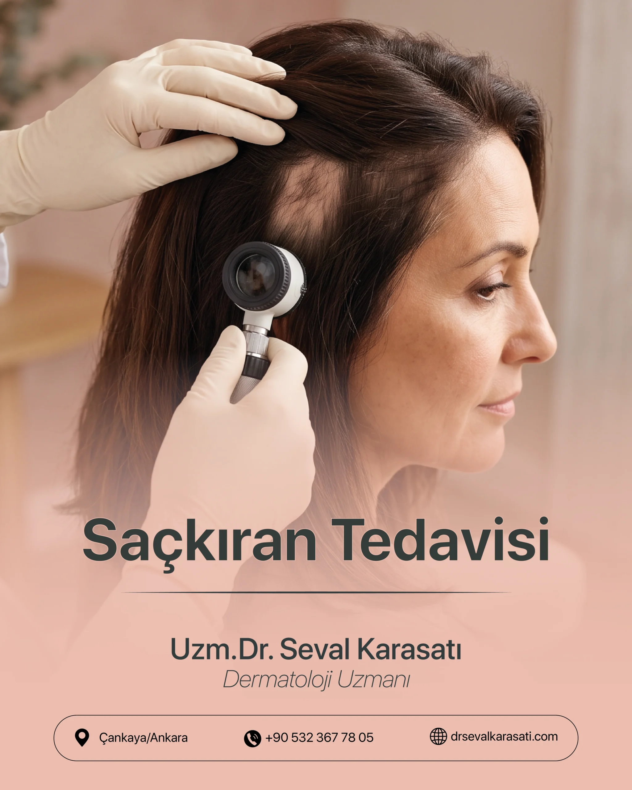 Saçkıran Tedavisi