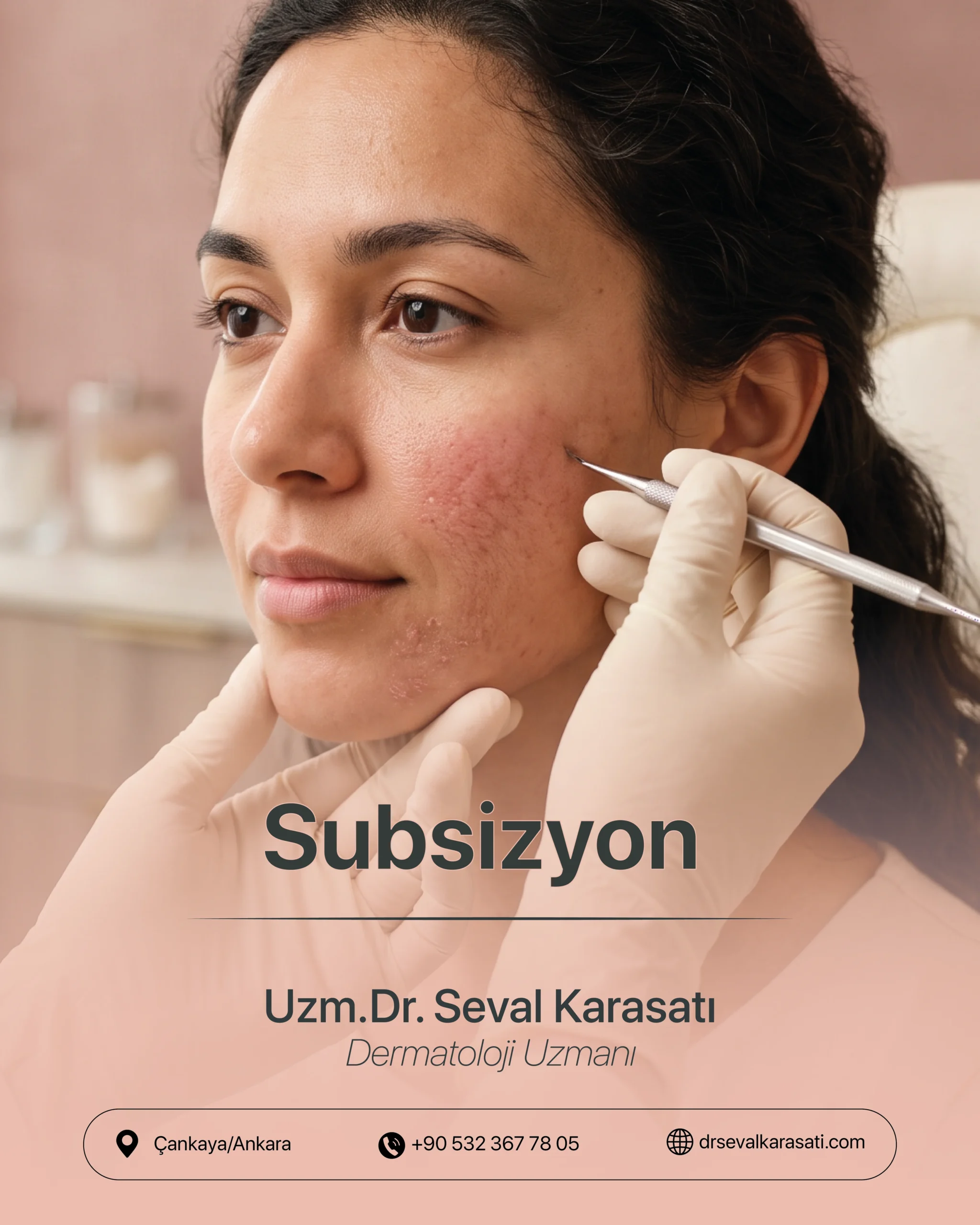 Subsizyon
