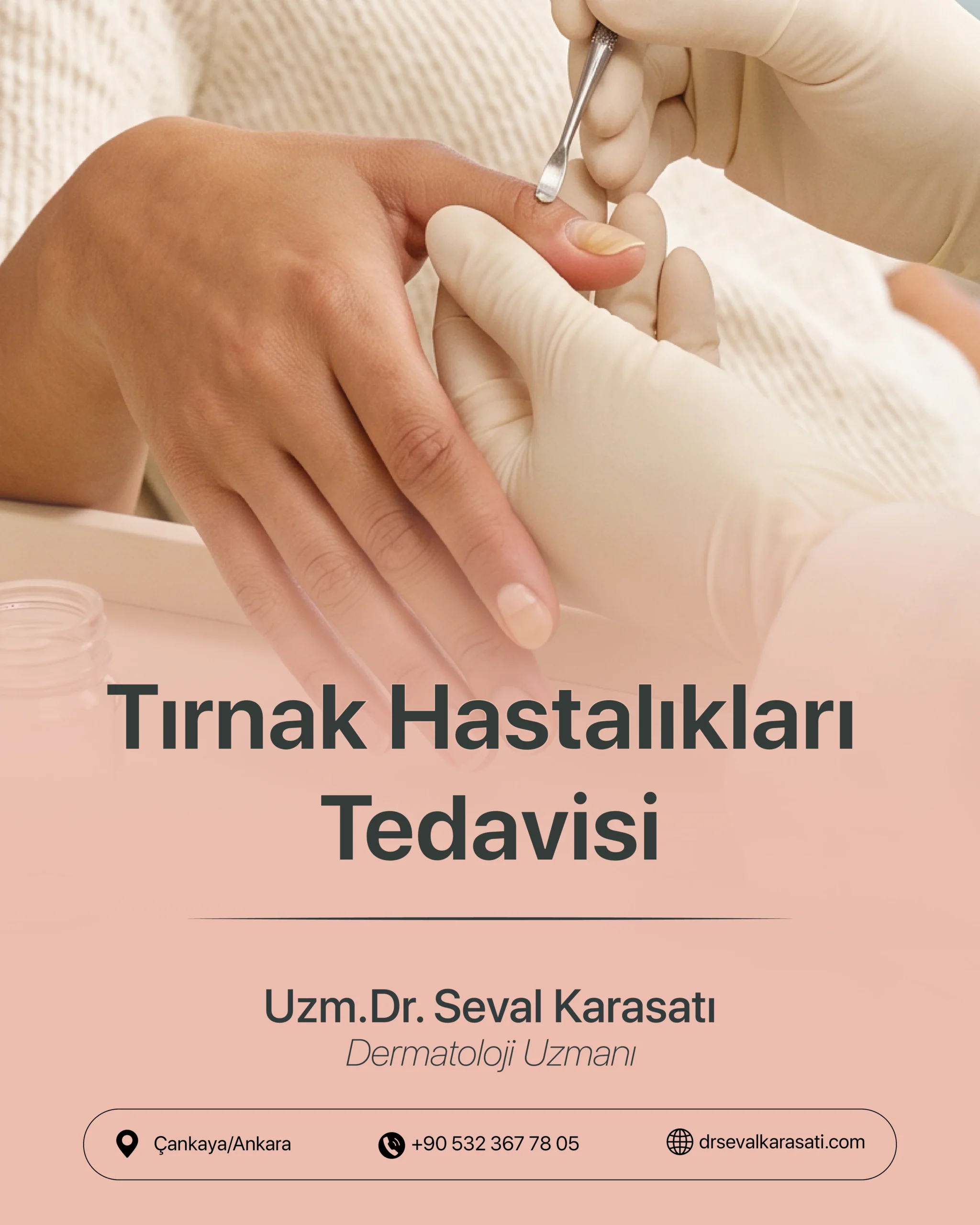 Tırnak Hastalıkları Tedavisi