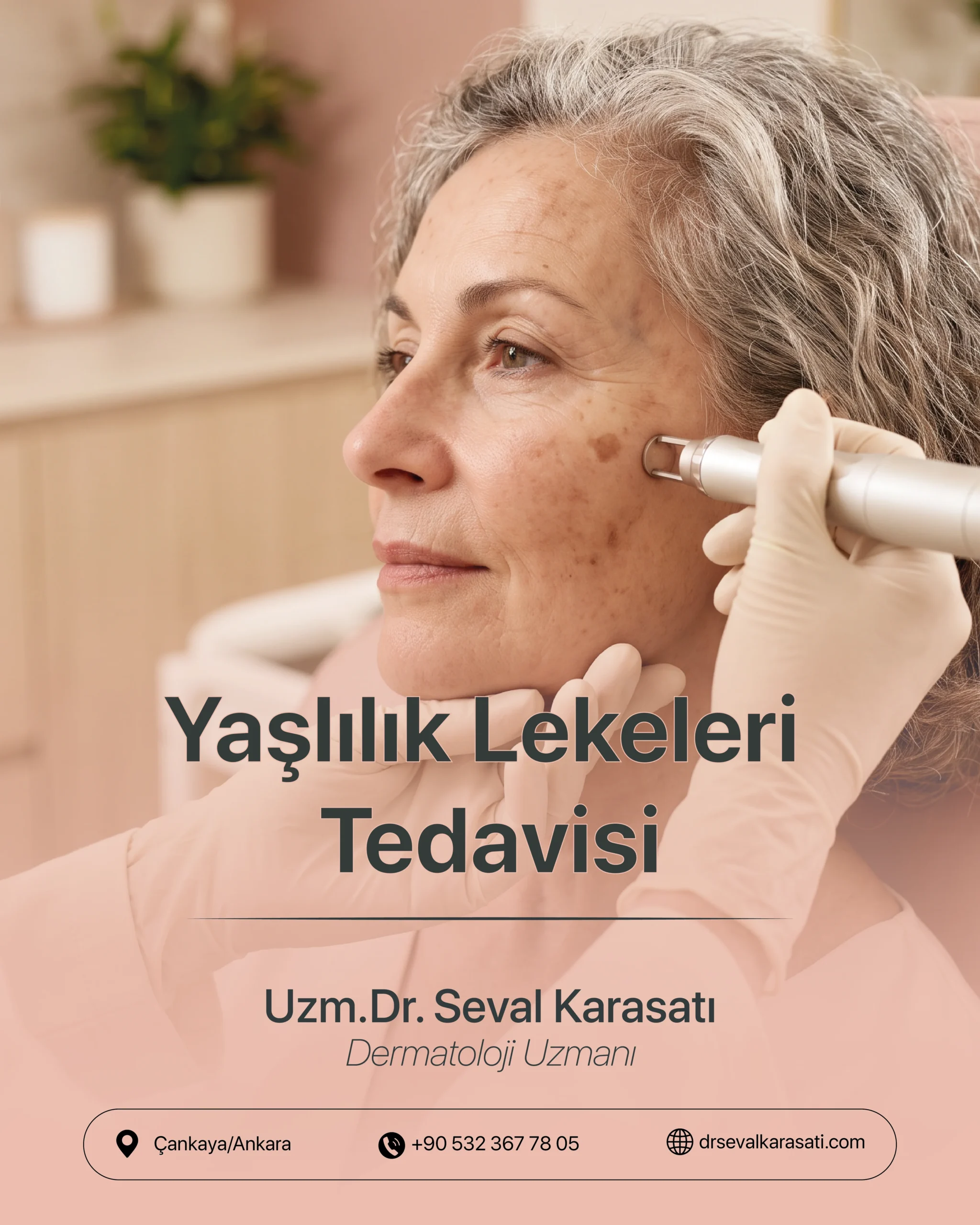 Yaşlılık Lekeleri Tedavisi