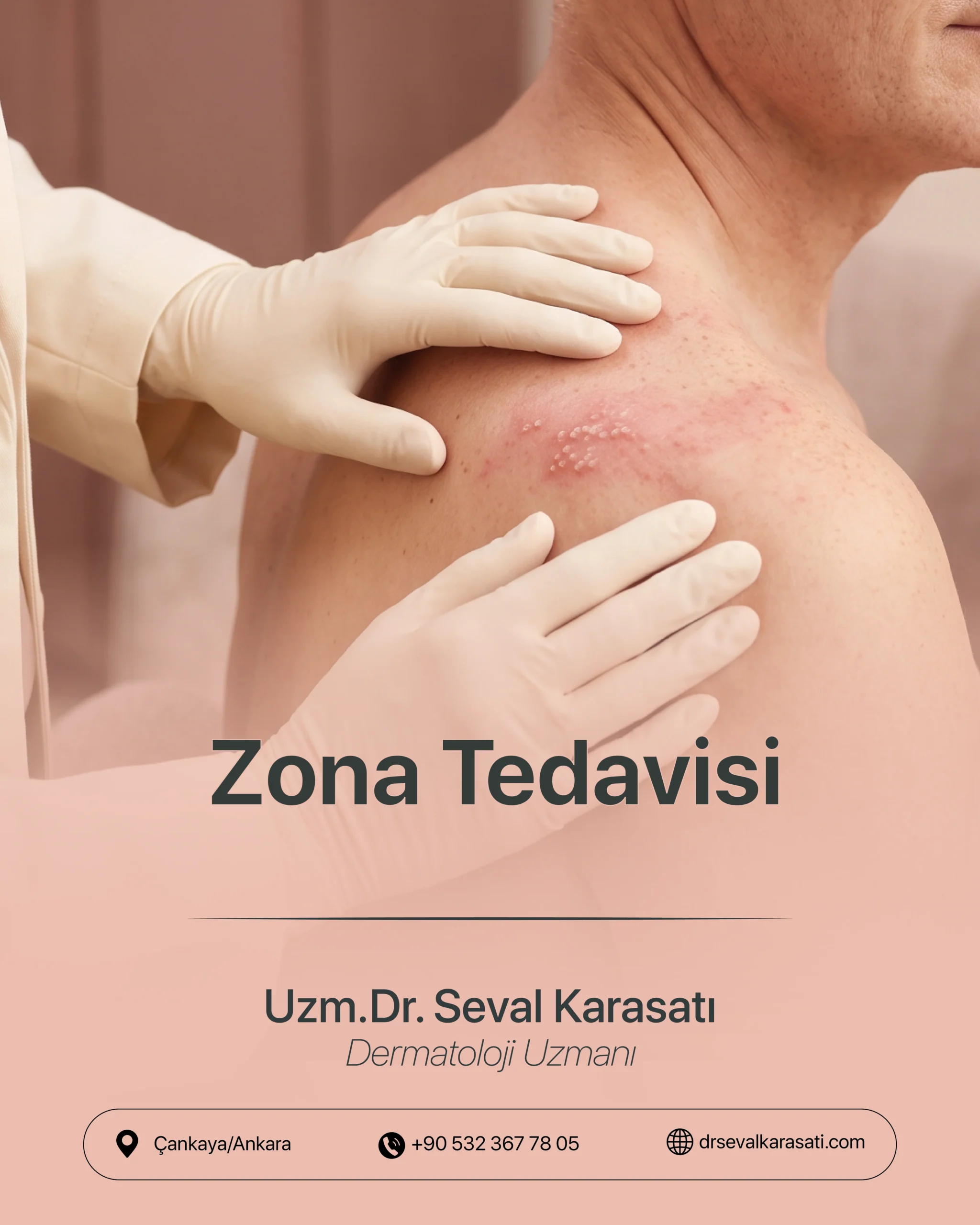 Zona Tedavisi
